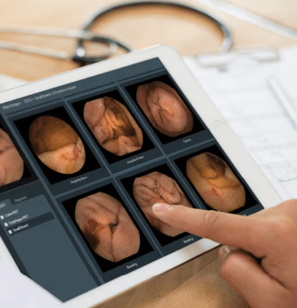 PillCam Software v9